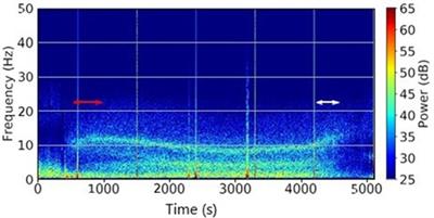 Assessment of the depth of anesthesia with hidden Markov model based on cardiopulmonary variables